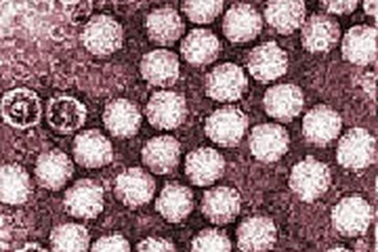 Giám sát một bệnh truyền nhiễm nguy hiểm từ châu Phi 