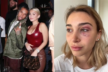 Rapper Tyga bị bắt vì bạo hành bạn gái mới