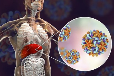 Loại virus được gọi là "kẻ giết người thầm lặng" nhiều người Việt mắc phải