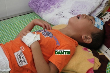 Xuất hiện trường hợp não mô cầu đầu tiên ở Nghệ An