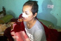 Kinh hoàng đòn ghen: Cắt tóc, chà quả ngứa khắp người tình địch