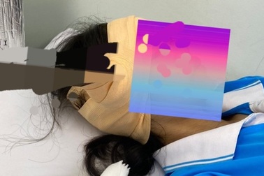 Một học sinh bị dao găm vào đầu sau giờ học thể dục tại trường