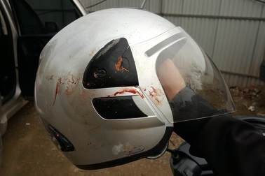 Nhà báo Đỗ Doãn Hoàng thoát chết nhờ chiếc mũ bảo hiểm