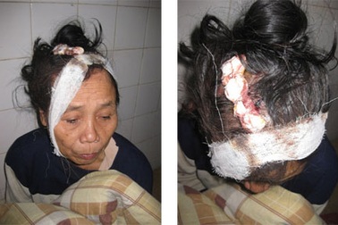 Đi làm thuê, một nữ phu bị đánh vỡ đầu