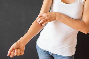 Khoa học chỉ ra 5 biểu hiện trên da có thể là dấu hiệu mắc Covid-19