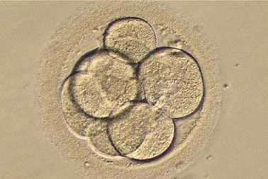 Thụ tinh trong ống nghiệm làm tăng nguy cơ biến chứng thai kỳ