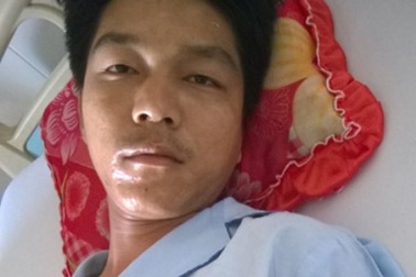 Bị chém lìa bàn tay trái khi dừng lại xem cãi nhau?