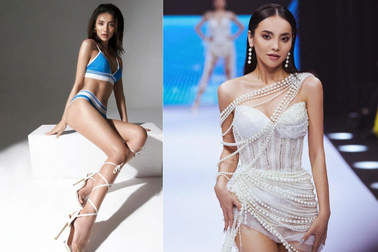 Thí sinh Hoa hậu Hoàn vũ Việt Nam từng khâu 7 mũi, tự ti vì vết sẹo ở trán