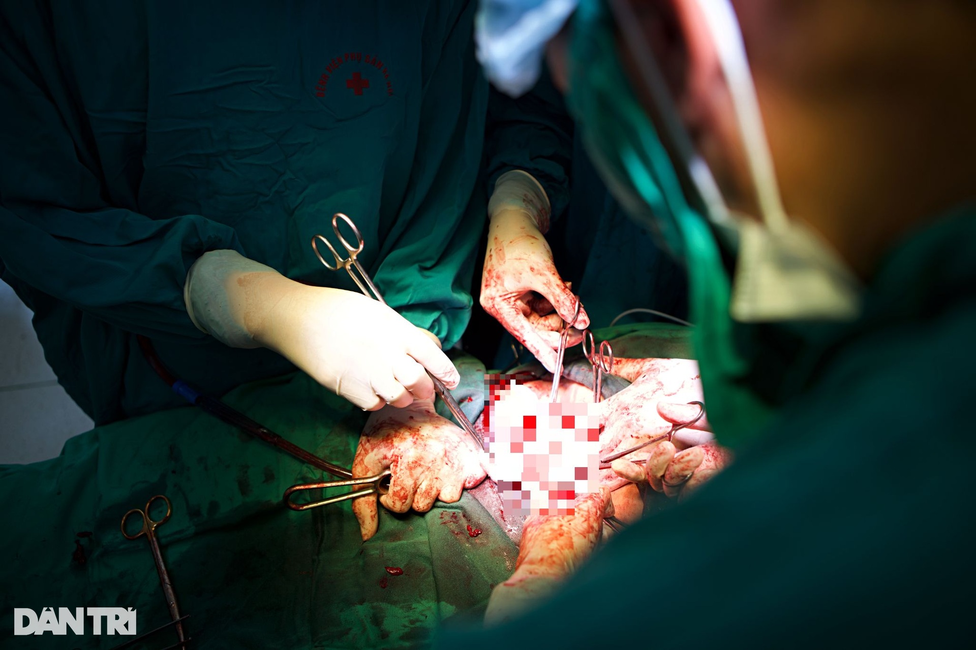 Nghẹt thở cuộc đua máu trong phòng mổ cấp cứu sản khoa - 13 Nghẹt thở cuộc đua máu trong phòng mổ cấp cứu sản khoa - 13