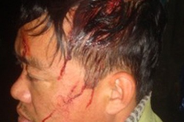 Truy quét lâm tặc giữa đêm, cán bộ khu bảo tồn bị chém trọng thương