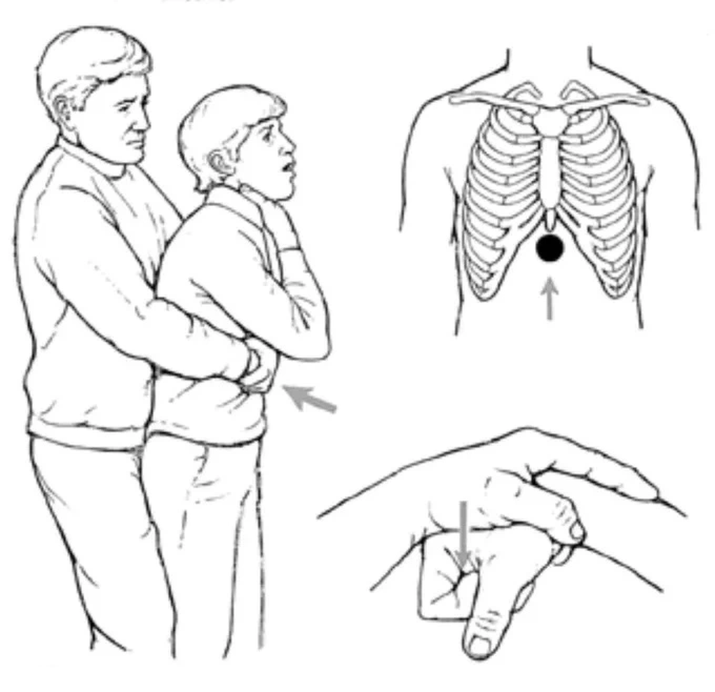 Mẹ nhanh trí cứu con gái bị hóc kẹo, đoạn video khiến người xem nghẹt thở - 1 Mẹ nhanh trí cứu con gái bị hóc kẹo, đoạn video khiến người xem nghẹt thở - 1