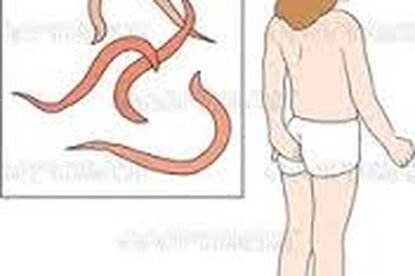 Bé gái tiểu dầm: Truy tầm giun kim