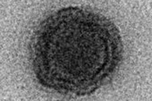 Phát hiện virus bí ẩn ở Brazil có bộ gene hoàn toàn mới