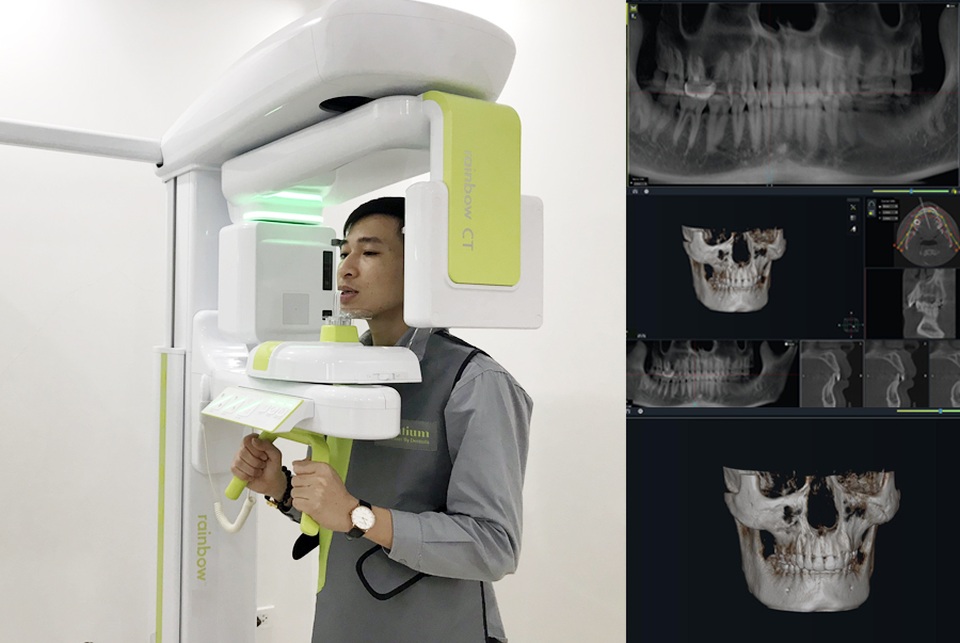 Nha khoa Lạc Việt Intech – Trung tâm trồng răng implant công nghệ cao - 2 Nha khoa Lạc Việt Intech – Trung tâm trồng răng implant công nghệ cao - 2