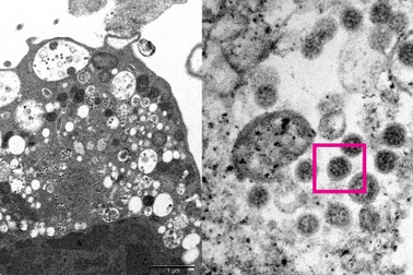 Hình ảnh đầu tiên của siêu biến chủng Omicron dưới kính hiển vi