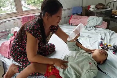 Người mẹ đáng thương chăm con tật nguyền bị bại não, máu khó đông, mù mắt
