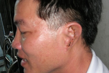 Bắt tạm giam "bồ nhí" cắt tai nguyên phó bí thư xã