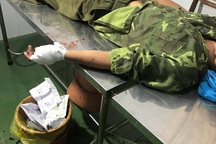 Hàng chục lâm tặc hung hãn vây chém kiểm lâm, giải cứu đồng bọn