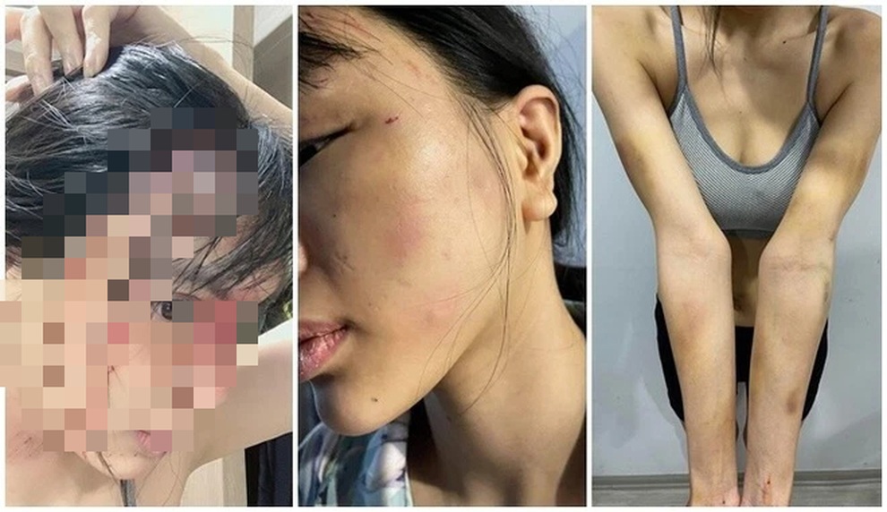 Vụ siêu mẫu bị đánh đập, cô gái phải quỳ gối: Hành vi hèn hạ, đáng lên án - 3 Vụ siêu mẫu bị đánh đập, cô gái phải quỳ gối: Hành vi hèn hạ, đáng lên án - 3