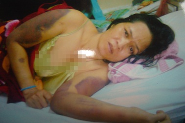 Trả lại hồ sơ vụ hai điều tra viên dùng nhục hình bức cung