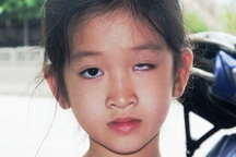 Học sinh bị ném thước tại trường khiến một mắt mù vĩnh viễn, gia đình bức xúc