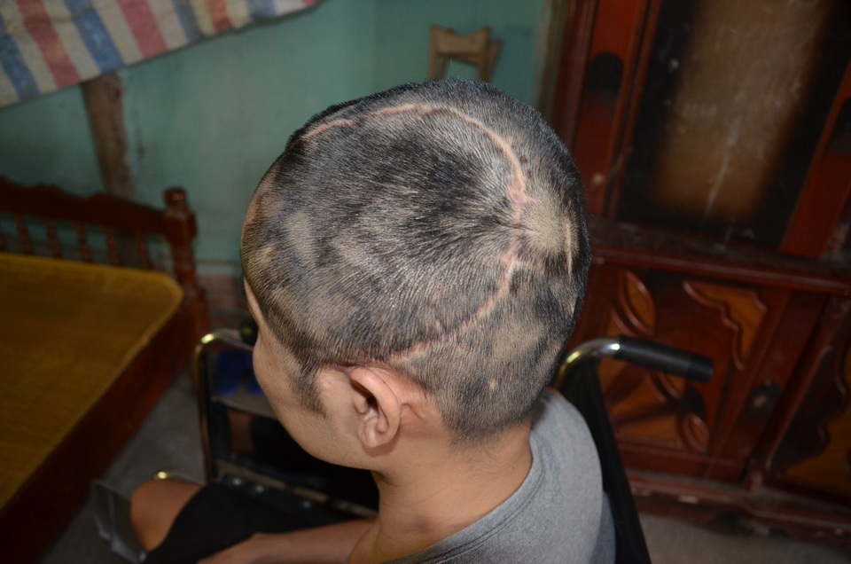 Cha bị tai nạn nằm liệt giường, đến giờ này hai con chưa có sách vở đi học - 1 Cha bị tai nạn nằm liệt giường, đến giờ này hai con chưa có sách vở đi học - 1