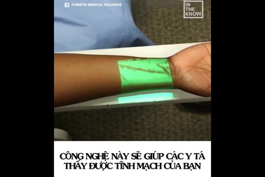 Bạn có thể nhìn “rõ mồn một” mạch máu của mình với thiết bị này!