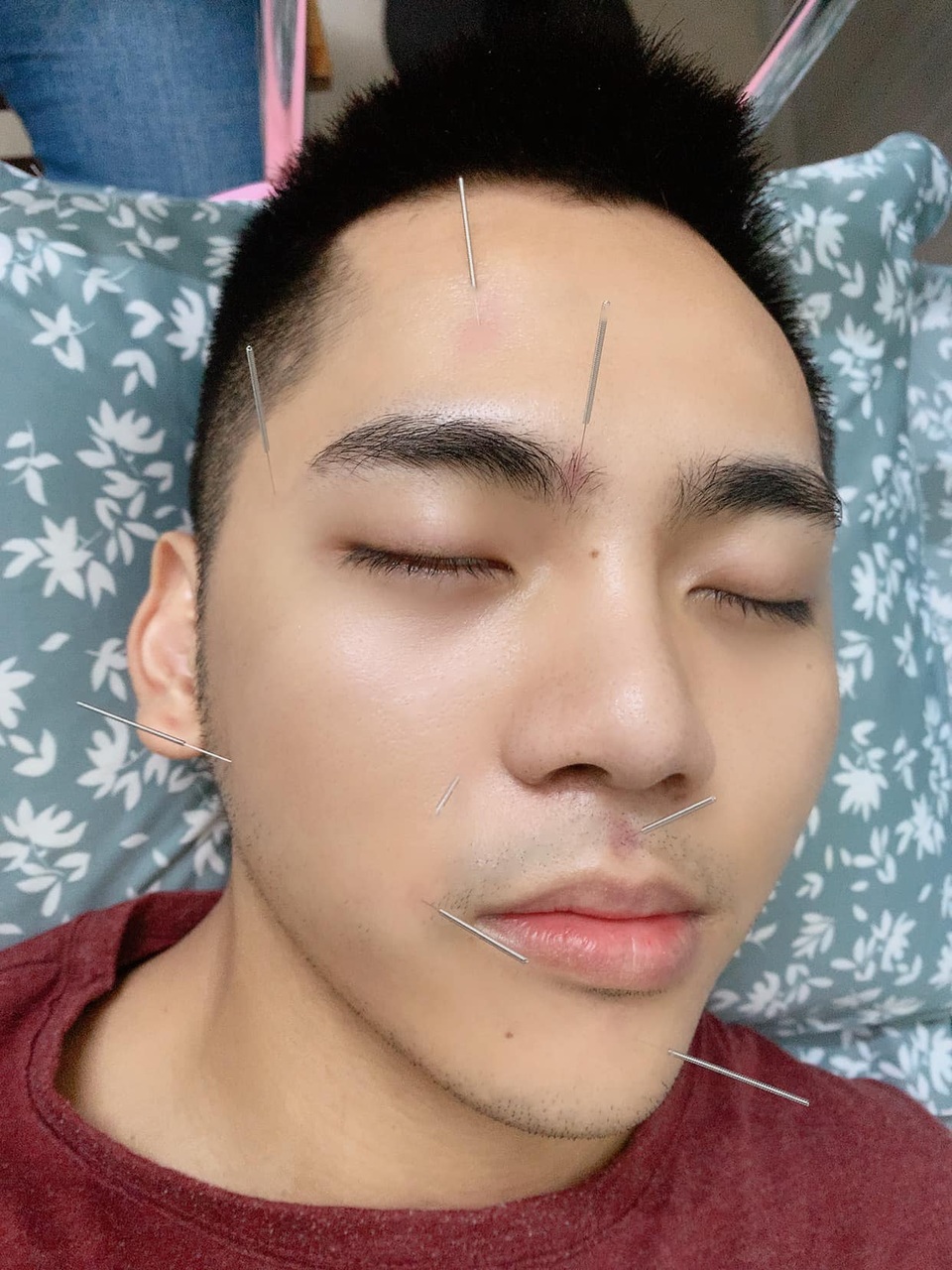 Lời cảnh tỉnh của chàng Youtuber sau hành trình chữa trúng gió méo miệng - 4 Lời cảnh tỉnh của chàng Youtuber sau hành trình chữa trúng gió méo miệng - 4