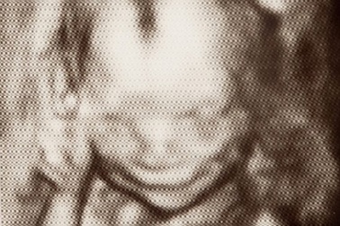 Thai nhi 17 tuần tuổi biết cười