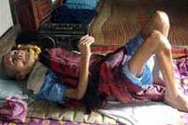 Bệnh lạ gây chết người ở Bình Định 