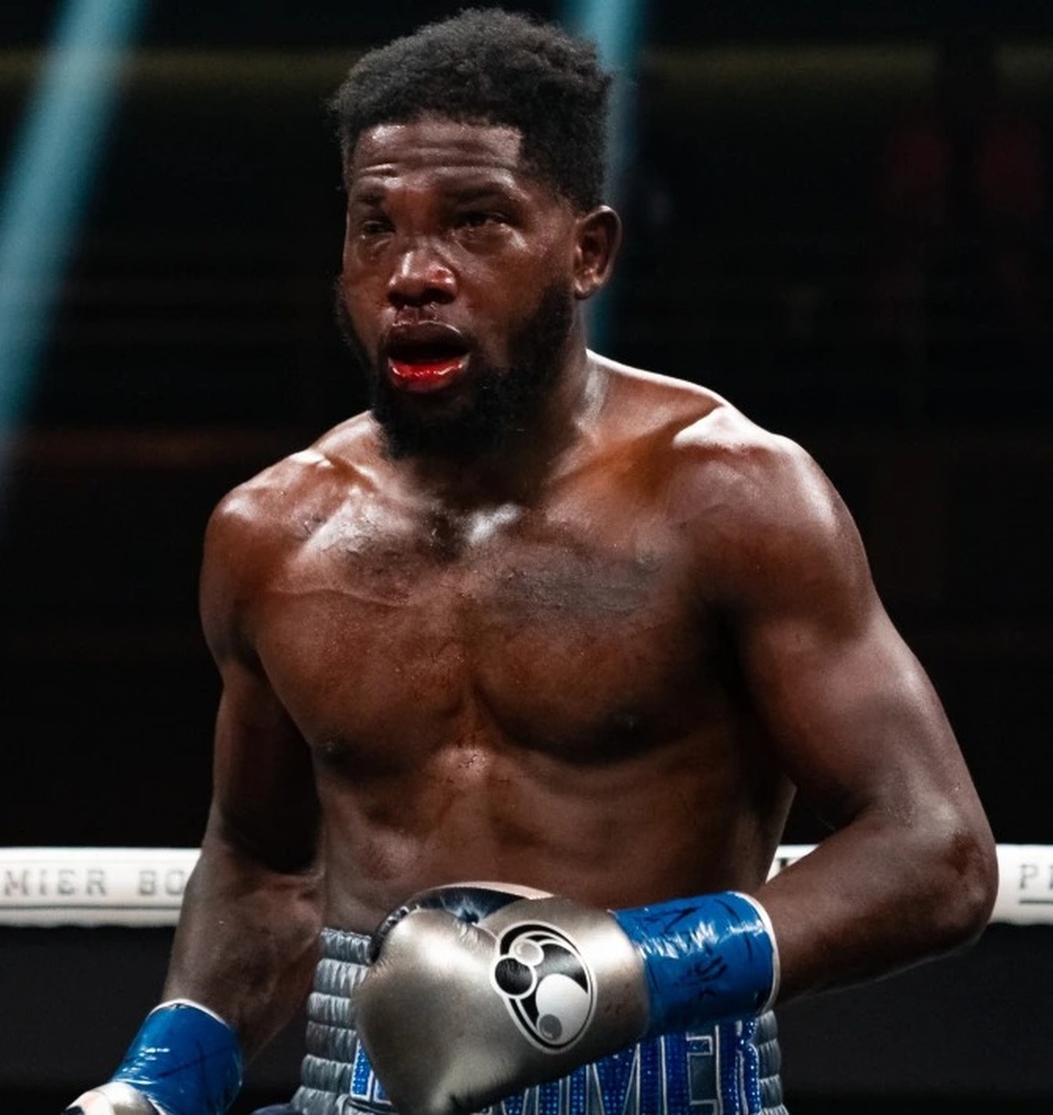 Khuôn mặt võ sĩ biến dạng khủng khiếp sau khi nhận 233 cú đấm - 1 Khuôn mặt võ sĩ biến dạng khủng khiếp sau khi nhận 233 cú đấm - 1