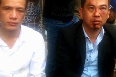 Khởi tố vụ án 2 luật sư bị nhóm côn đồ tấn công