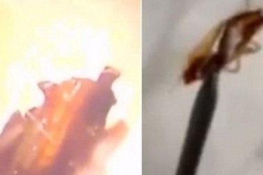 Kinh hãi bác sĩ gắp gián “ngoe nguẩy” khỏi tai người phụ nữ