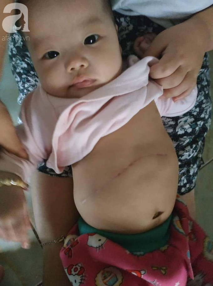 Xót cảnh bố mẹ trẻ tật nguyền đi làm thuê, gom góp tiền níu giữ mạng sống từng ngày cho con gái 9 tháng tuổi - Ảnh 2. Xót cảnh bố mẹ trẻ tật nguyền đi làm thuê, gom góp tiền níu giữ mạng sống từng ngày cho con gái 9 tháng tuổi - Ảnh 2.