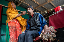 Mụn cóc khổng lồ mọc đầy tay chân, vận nghèo đeo bám "người cây" Bangladesh