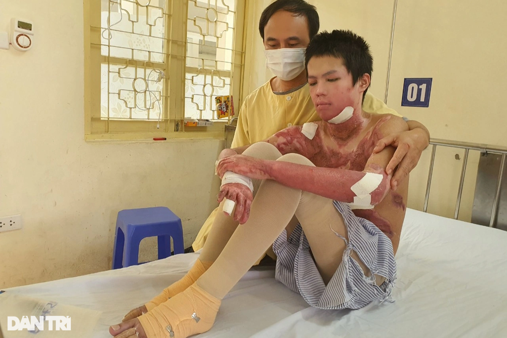 Bạn đọc Dân trí giúp đỡ cậu bé bỏng điện 55% cơ thể hơn 320 triệu đồng - 2 Bạn đọc Dân trí giúp đỡ cậu bé bỏng điện 55% cơ thể hơn 320 triệu đồng - 2