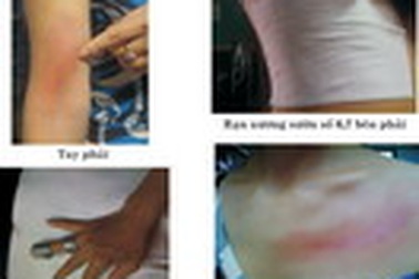 Xử lý hành chính đối tượng đánh người gây thương tích tại 33 Hàng Mã