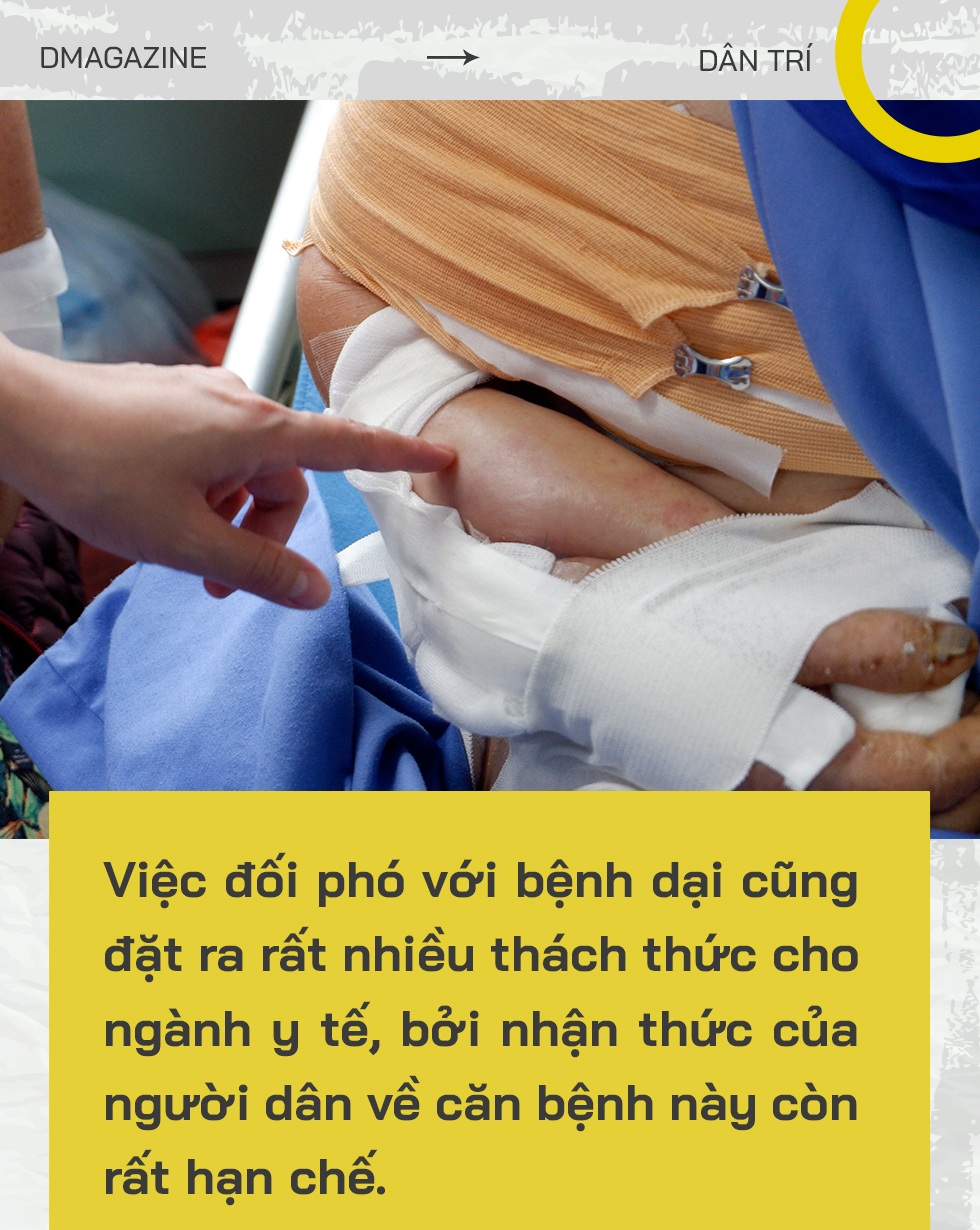Nhát cắn đoạt mạng: Chết oan vì chó thả rông, thú cưng hóa điên phản chủ - 18 Nhát cắn đoạt mạng: Chết oan vì chó thả rông, thú cưng hóa điên phản chủ - 18
