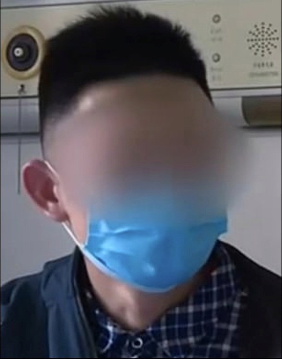 Khó thở kéo dài, phát hiện sán đầy trong phổi - 1