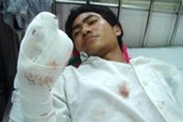 TPHCM: Lại một vụ nổ “bom quà” thương tâm