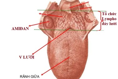 Khối, nốt đỏ sau lưỡi và đáy lưỡi - u hay ung thư?