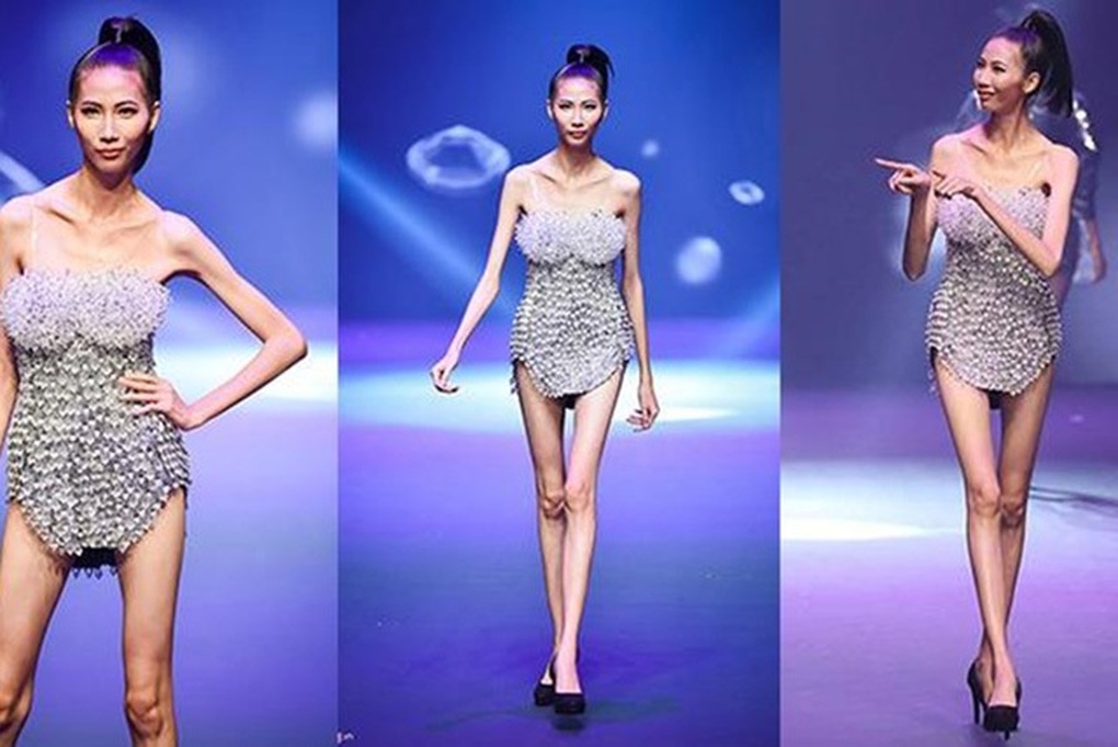 Giới trẻ tranh luận về quyền chê bai ngoại hình của người nổi tiếng - 1 Giới trẻ tranh luận về quyền chê bai ngoại hình của người nổi tiếng - 1