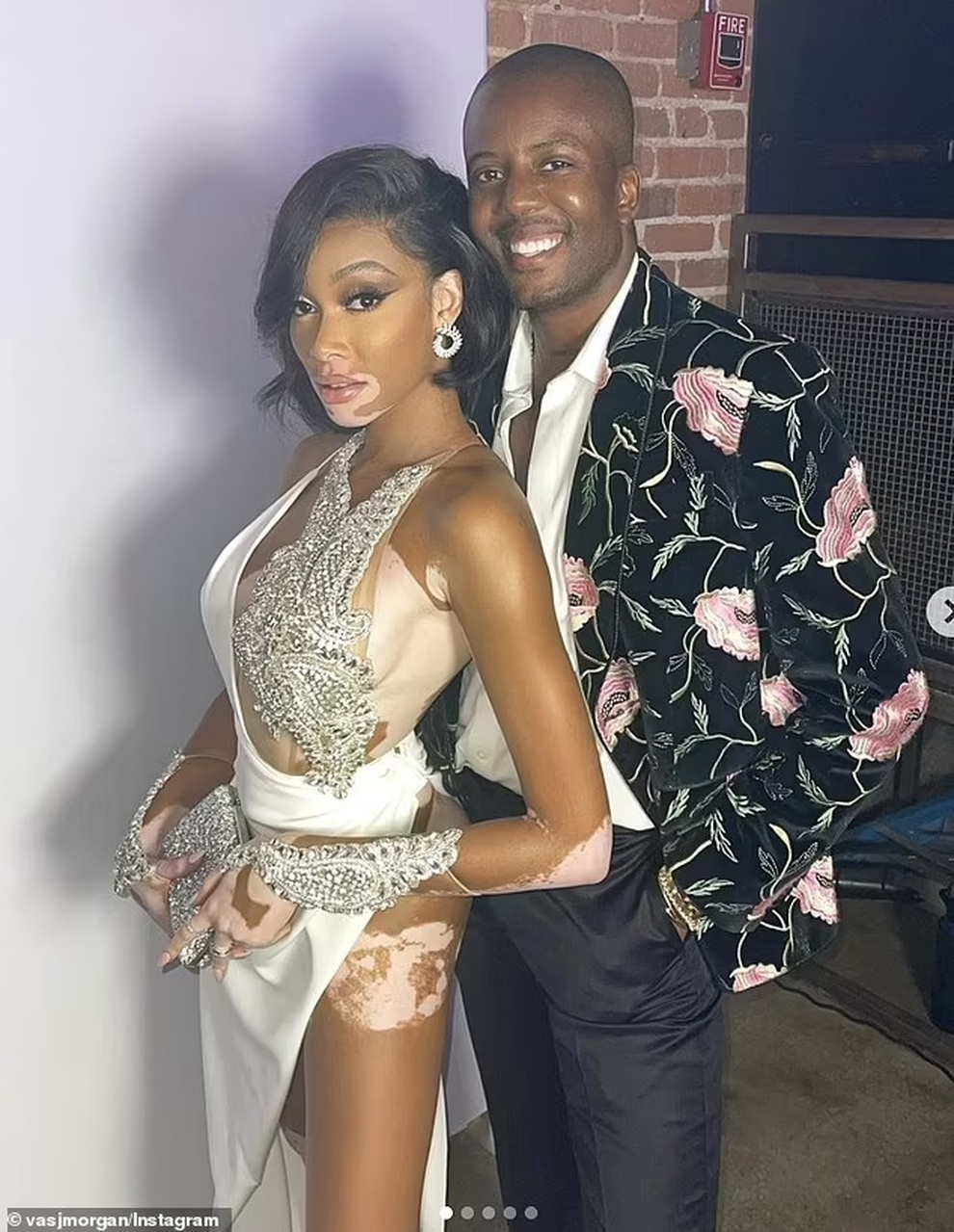Siêu mẫu bạch biến Winnie Harlow gây choáng với váy xẻ bất tận - 2 Siêu mẫu bạch biến Winnie Harlow gây choáng với váy xẻ bất tận - 2