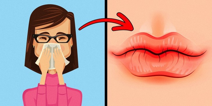 8 dấu hiệu của đôi môi tiết lộ tình trạng sức khoẻ của bạn - Ảnh 2. 8 dấu hiệu của đôi môi tiết lộ tình trạng sức khoẻ của bạn - Ảnh 2.