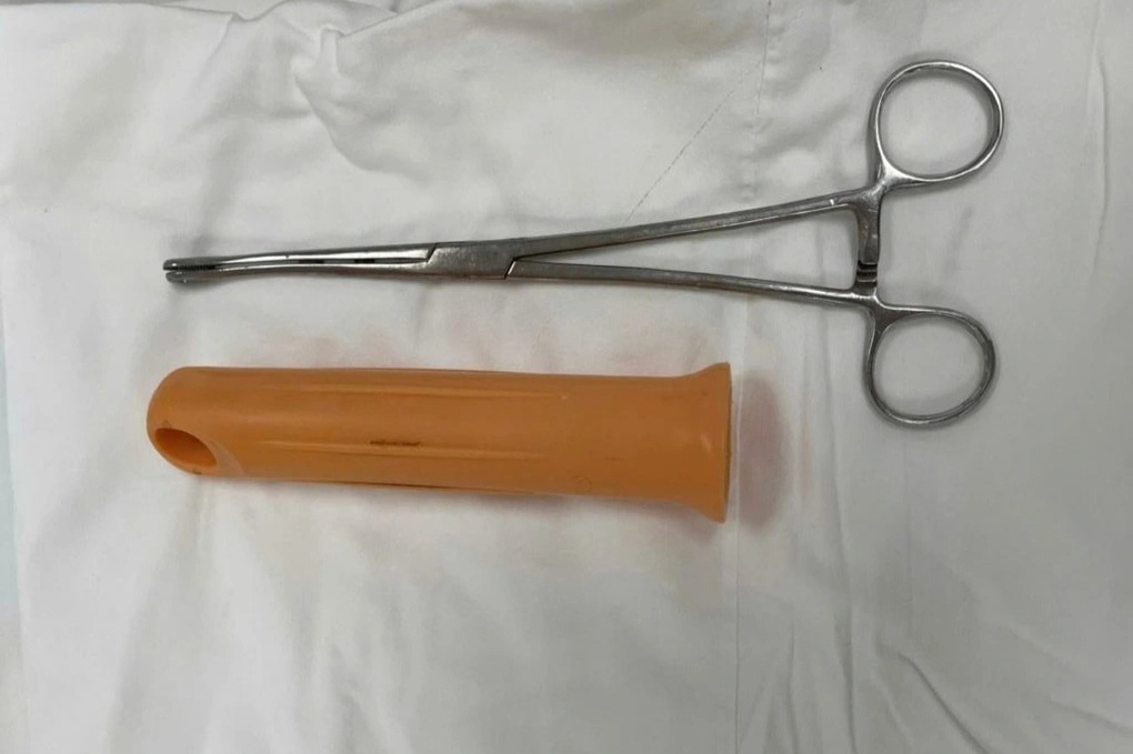 Nam thanh niên bị mắc kẹt cán cây lau nhà 15cm trong hậu môn - 2 Nam thanh niên bị mắc kẹt cán cây lau nhà 15cm trong hậu môn - 2