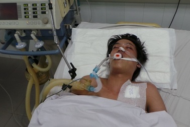 Vỡ mạch máu não, sinh mạng chàng trai nghèo nguy cấp