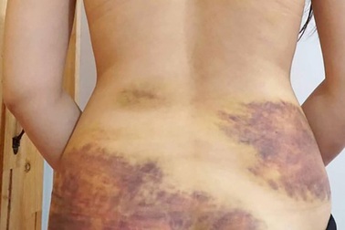 Đề nghị xác minh, xử lý nghiêm sự việc chồng hành hung vợ tại Tây Ninh