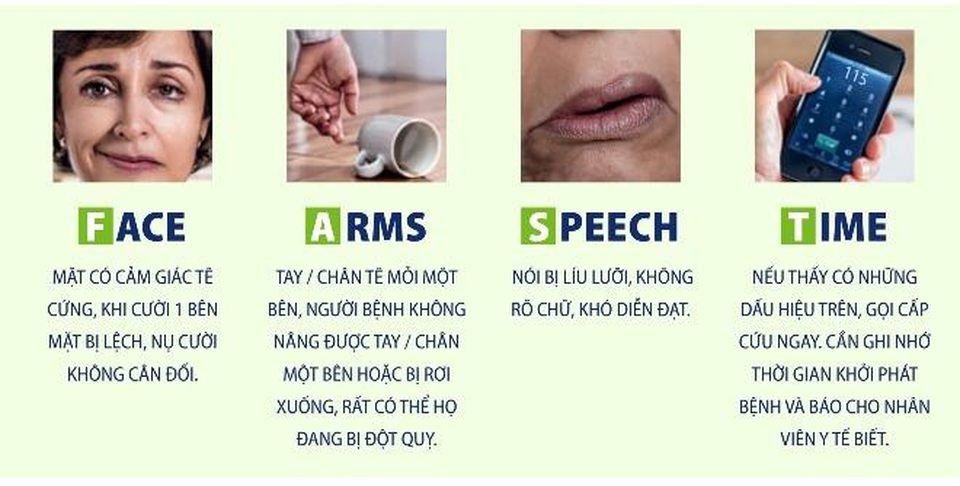 Dấu hiệu tai biến mạch máu não và cách phòng ngừa nhờ Nattospes - 1 Dấu hiệu tai biến mạch máu não và cách phòng ngừa nhờ Nattospes - 1