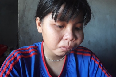 Nữ sinh 8 năm chống chọi với bệnh tật mong có tiền phẫu thuật khối u trên mặt