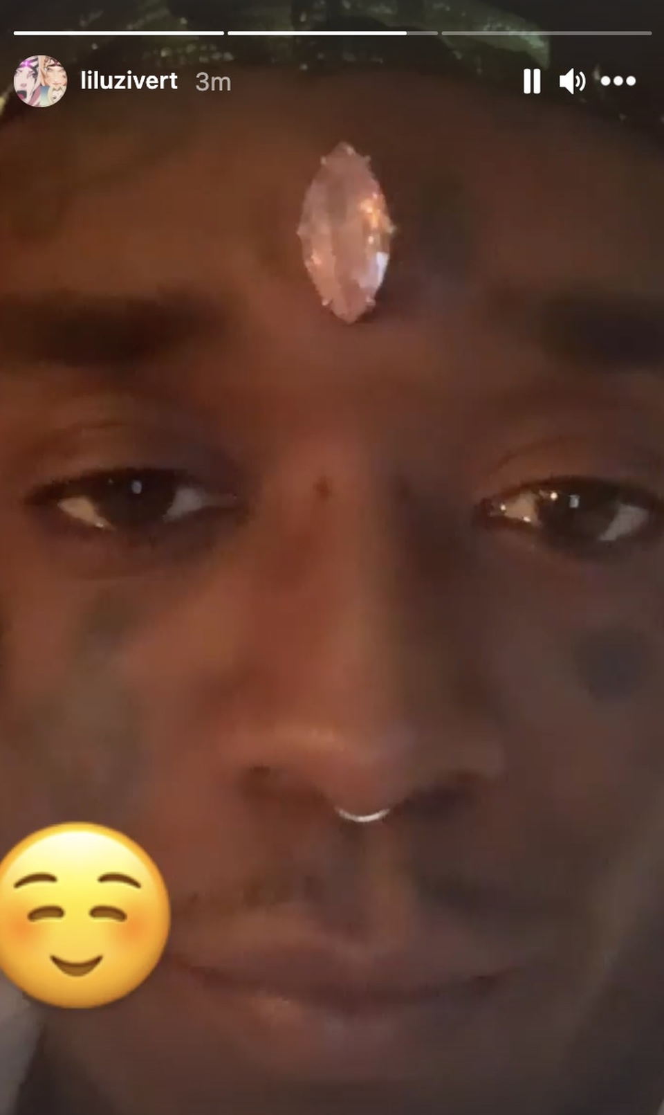 American rapper shocked when he put a 24 million USD diamond on his forehead - 2